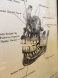 画像4: 1900'S 10'S 20'S　Haskell Post-Guraduate Dental College　CHICAGO　スカル　ドクロ　髑髏　デンタル解剖書　アーリーセンチュリー　メディカルアンティーク　ウッドフレーム　ウェーブガラス　ウォールデコ　アンティーク　ビンテージ (4)